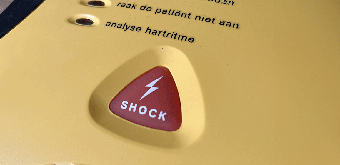 Halfautomaat of volautomaat: Waarom wij de volautomaat adviseren