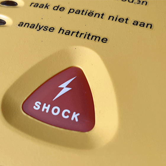 Halfautomaat of volautomaat: Waarom wij de volautomaat adviseren