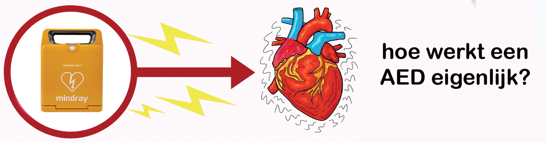 Hoe werkt een AED precies?
