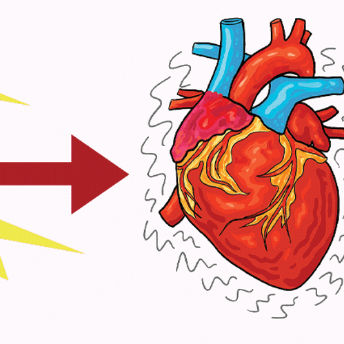 Hoe werkt een AED precies?