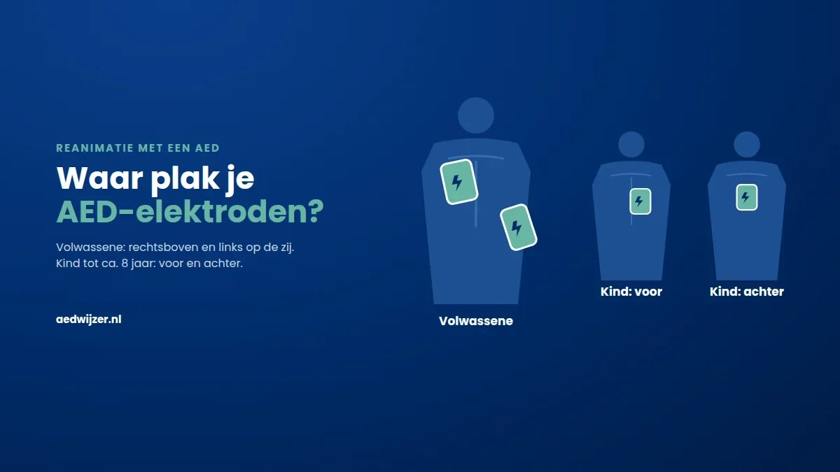Waar plak je AED-elektroden? Zo doe je het bij volwassenen en kinderen